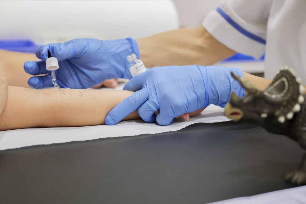 allergie alimentari test bambino gesù