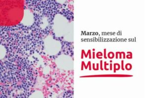Mieloma multiplo