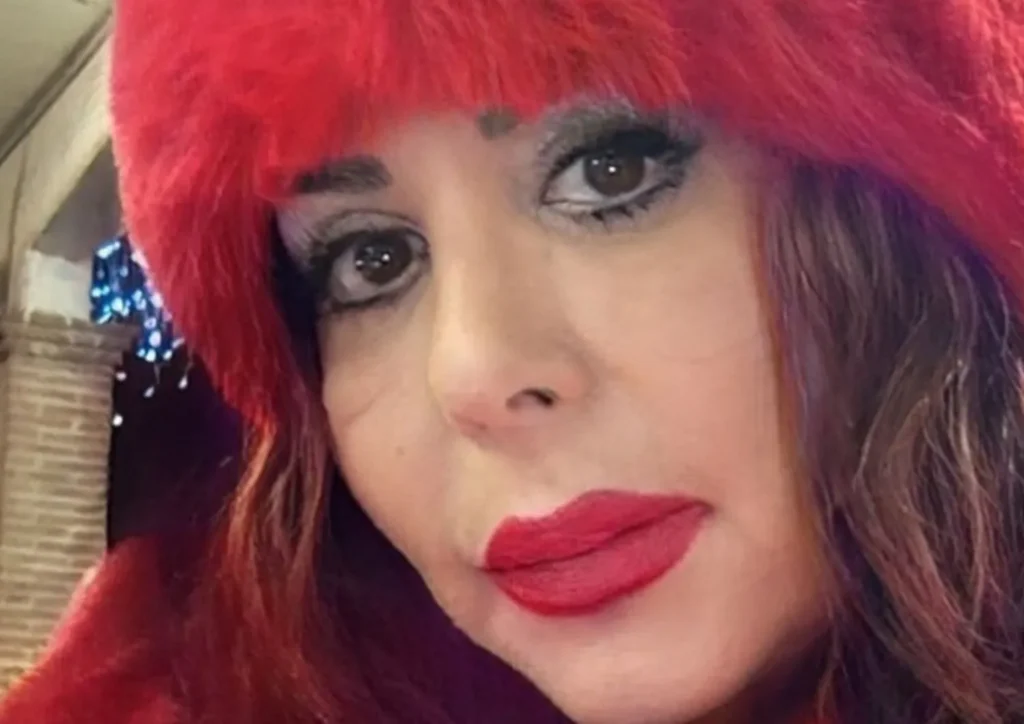 Simonetta Kalfus morta liposuzione
