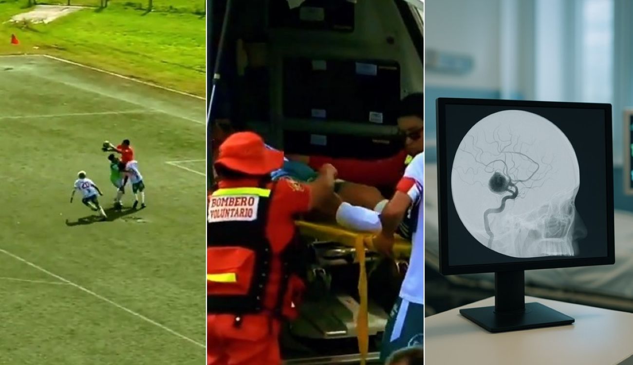 Calciatore collassa in campo per la rottura di un’arteria nella testa: è morto in ospedale