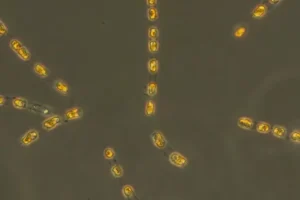 alghe Skeletonema marinoi