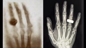 prima radiografia spazio