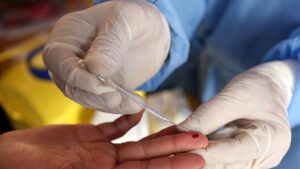 test sangue