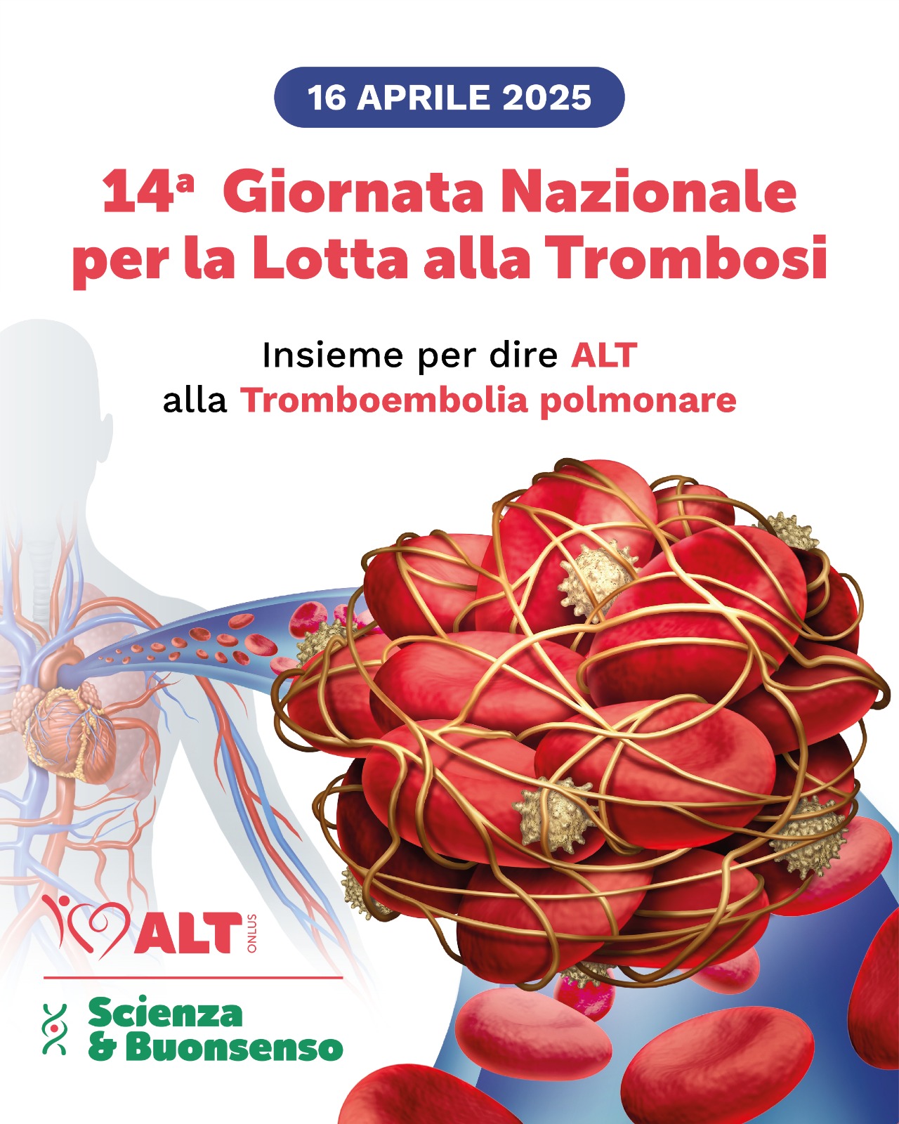 trombosi