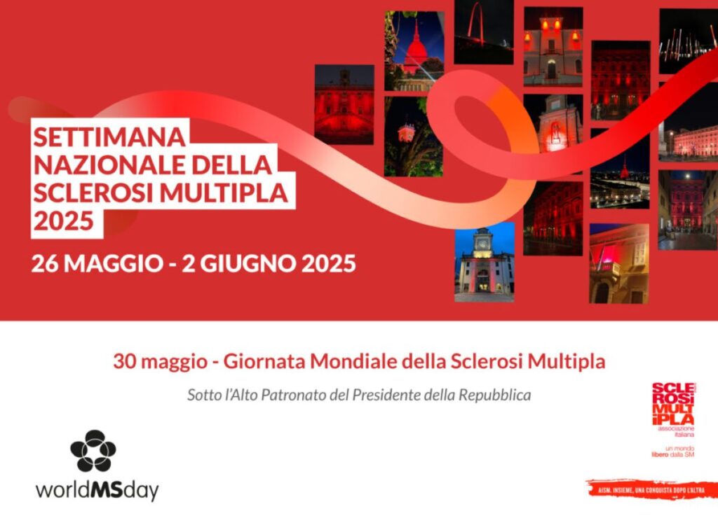 Sclerosi multipla