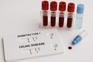 Celiachia diabete