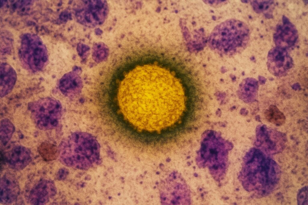 West Nile