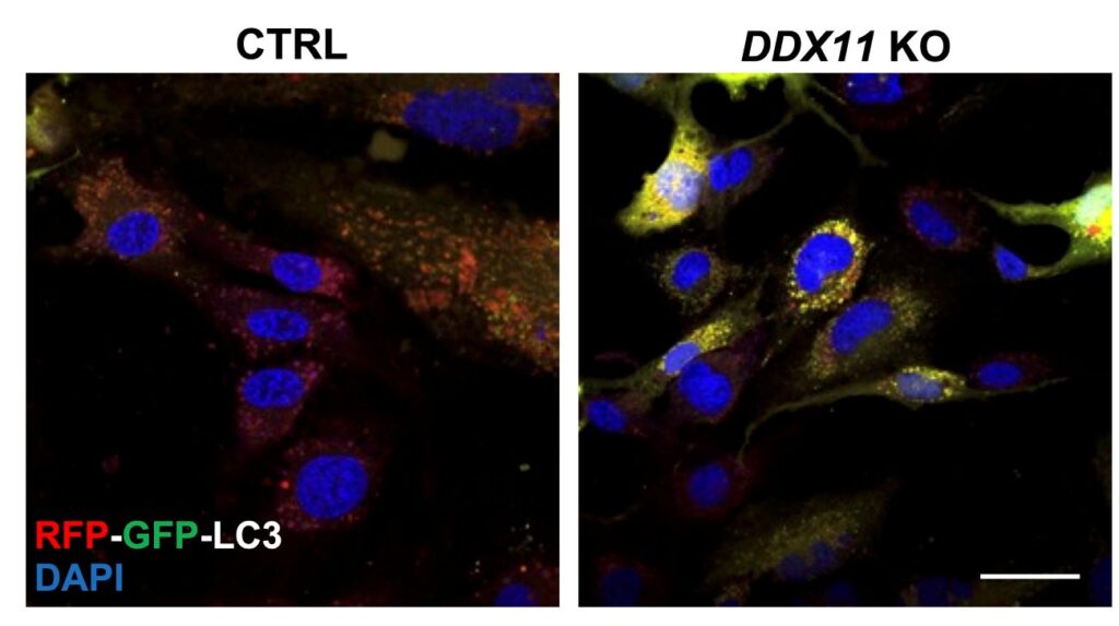 proteina DDX11