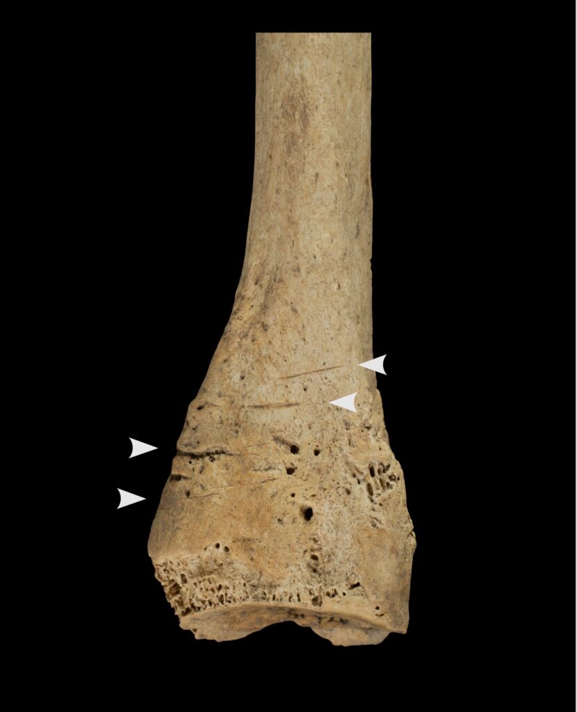 Cannibalismo preistorico
