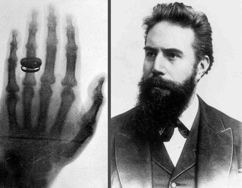 Wilhelm Conrad Röntgen raggi x