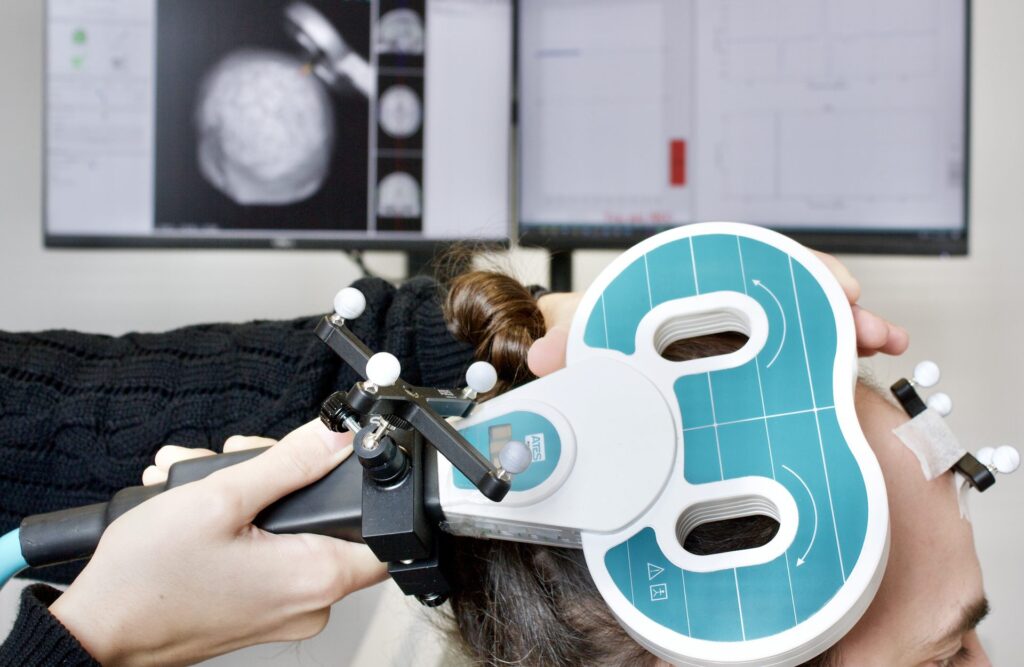 Strumentazione TMS studio muscoli - Università Statale di Milano