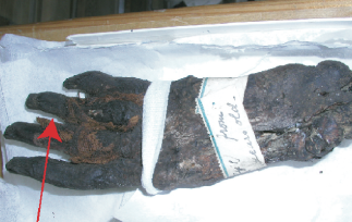 campioni mummie università bristol