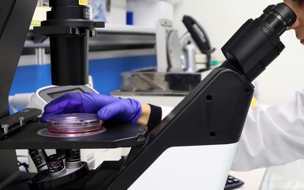 malattia di Still ricerca medica ANALISI CAMPIONE AL MICROSCOPIO