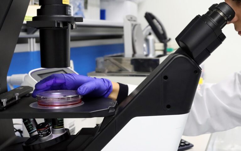 malattia di Still ricerca medica ANALISI CAMPIONE AL MICROSCOPIO