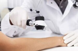 Melanoma