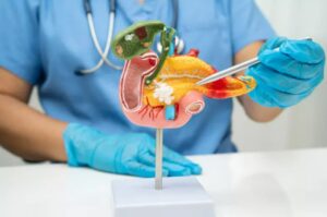 Tumore pancreas