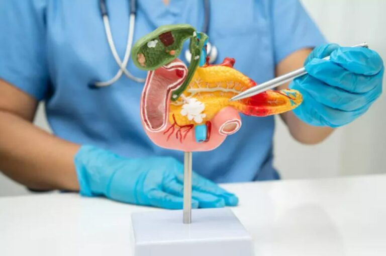 Tumore pancreas