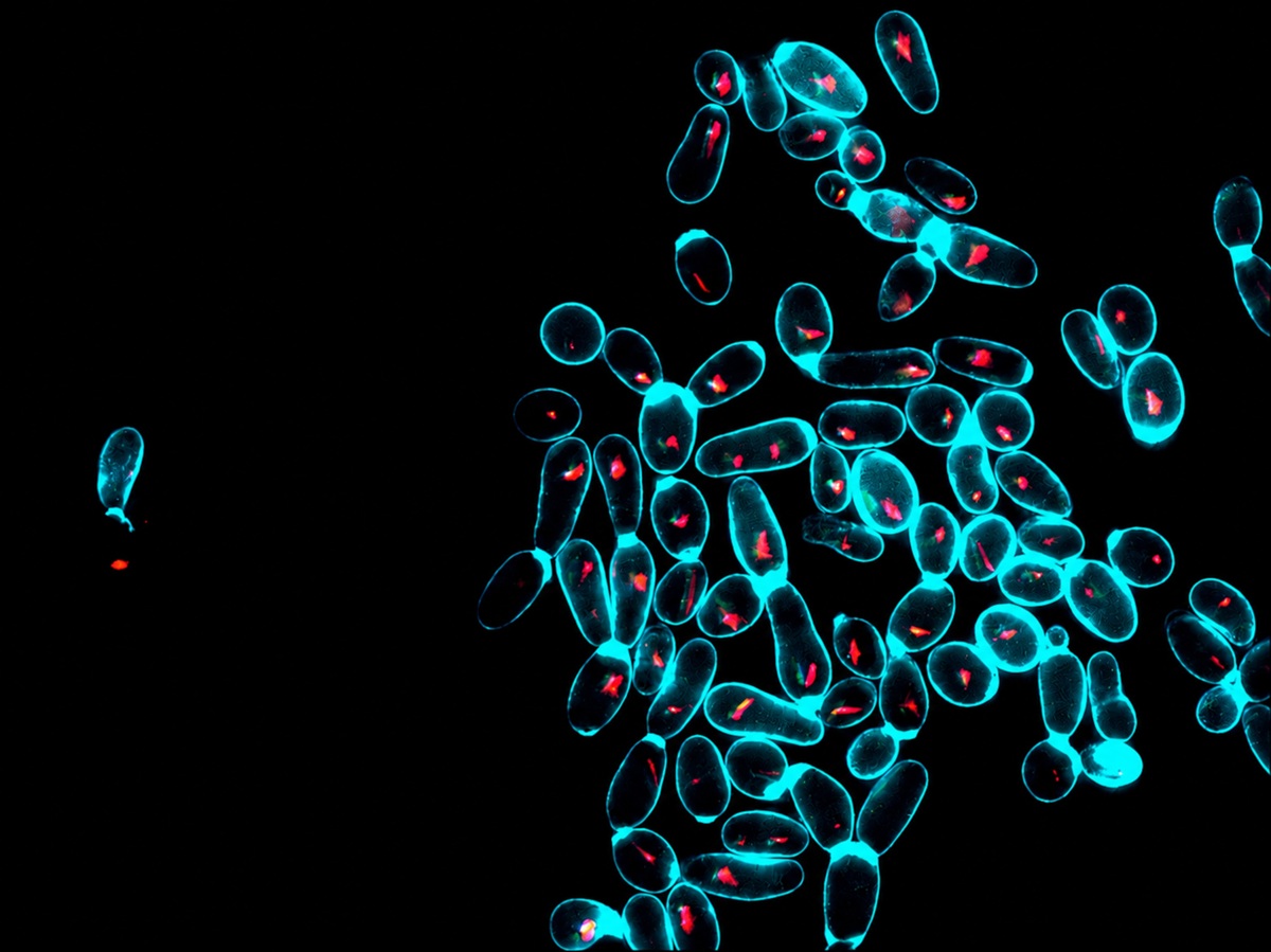 lieviti di Saccharomyces cerevisiae dello yaghnob cresciuti su galattosio (test del funzionamento mitocondriale)