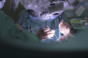 trapianto cornea bambino gesù
