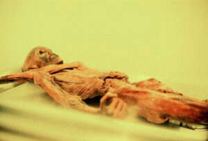 Ötzi