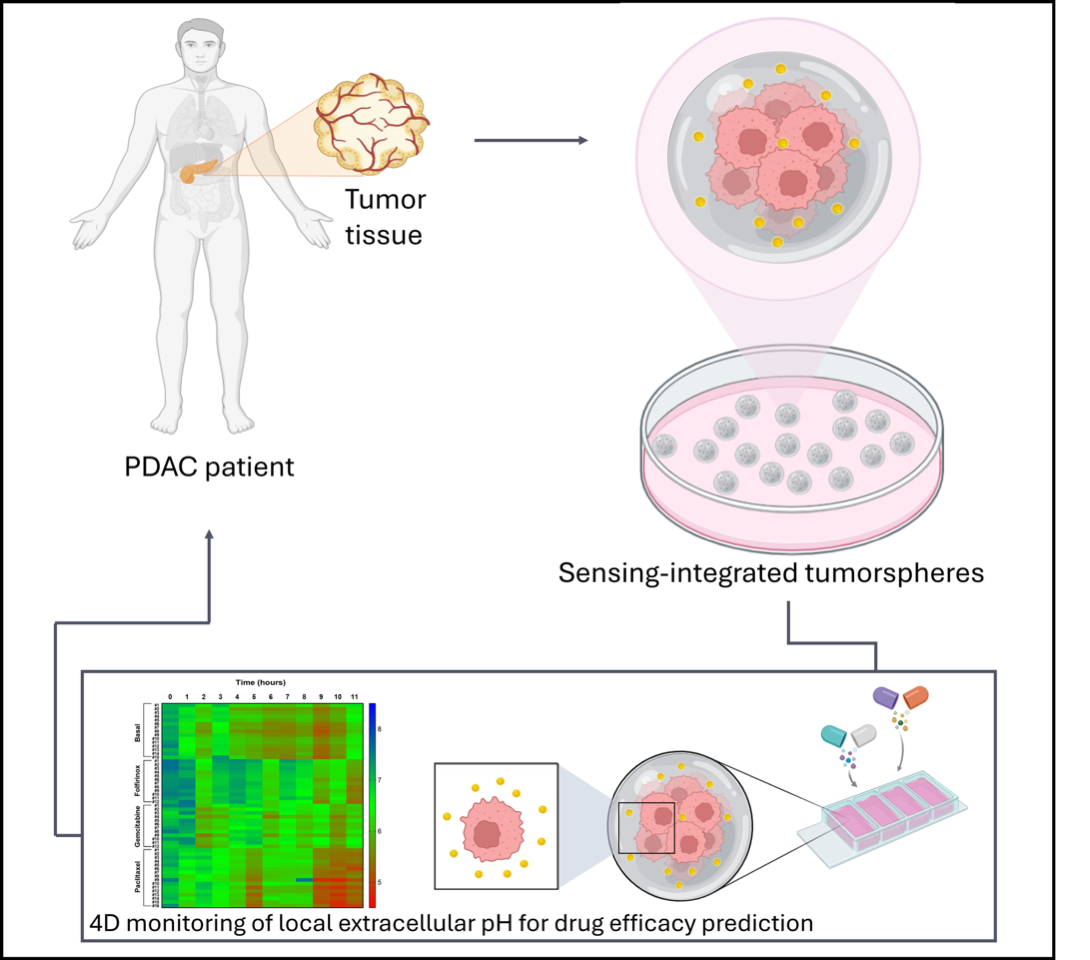 tumore pancreas